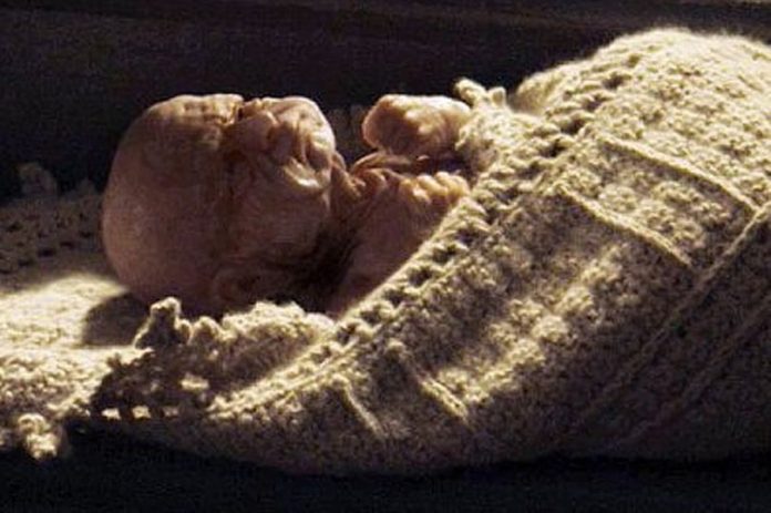 BENJAMIN-BUTTON-BABY-696x463.jpg