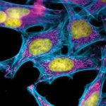 HeLa-cells-DNA-2