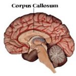 corpus-collosum